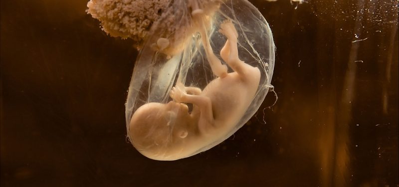 Αμνιακό υγρό: Τι είναι και γιατί είναι σημαντικό!